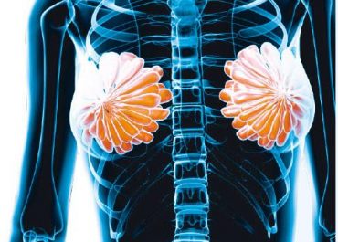 【乳癌電療】善用呼吸法護心 減輻射引致心病風險
